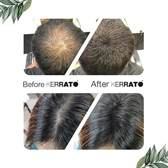 Kerrato Hair Fibres For Thinning Hair (Natural Black)