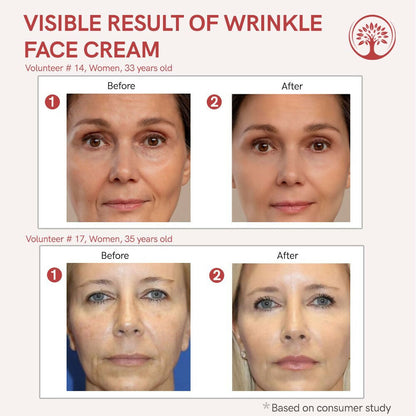 Ivory Natural Wrinkle Face Cream For More Radiant And Youthful Look