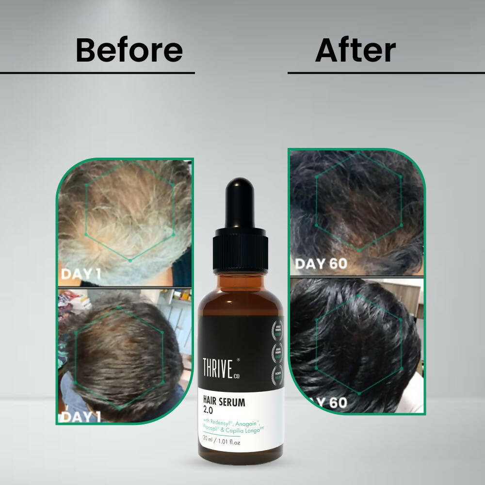 ThriveCo Hair Growth Serum 2.0