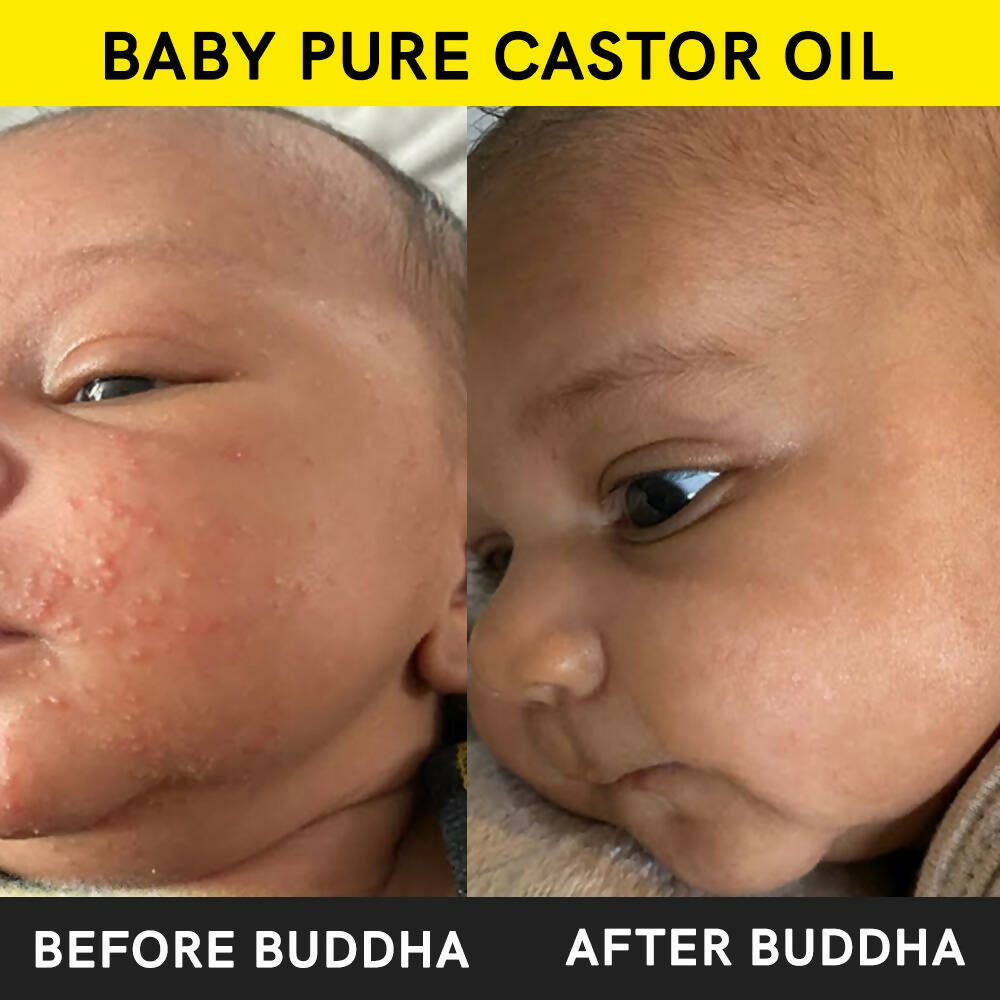 Buddha Natural Baby Castor Oil Cold Pressed Extra Virgin