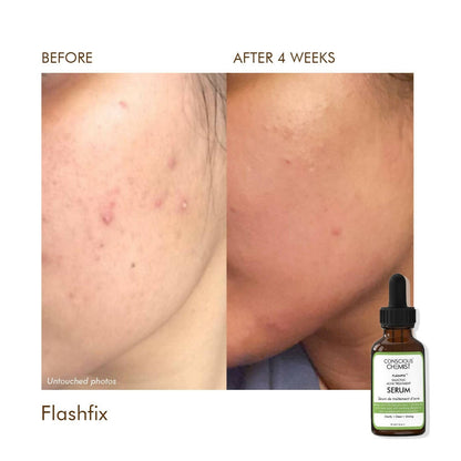 Conscious Chemist Flashfix Salicylic Acne Serum