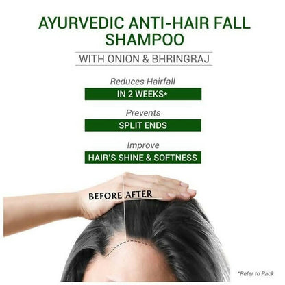Sesa Ayurvedic Anti-Hair Fall Onion Shampoo