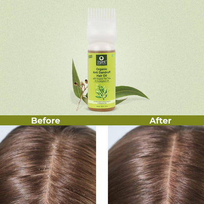 Organic Harvest Organic Anti Dandruff Hair Oil