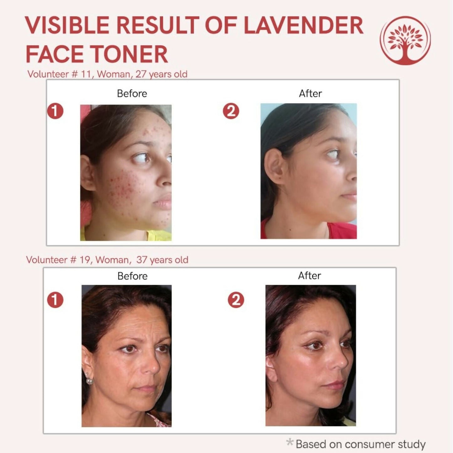 Ivory Natural Lavender Facial Toner For Acne, Even Skin Tone