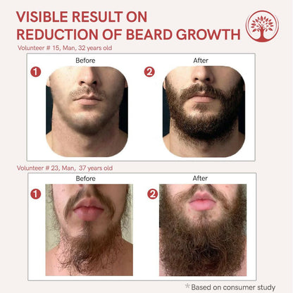 Ivory Natural Beard Growth Serum For Beard Wellness